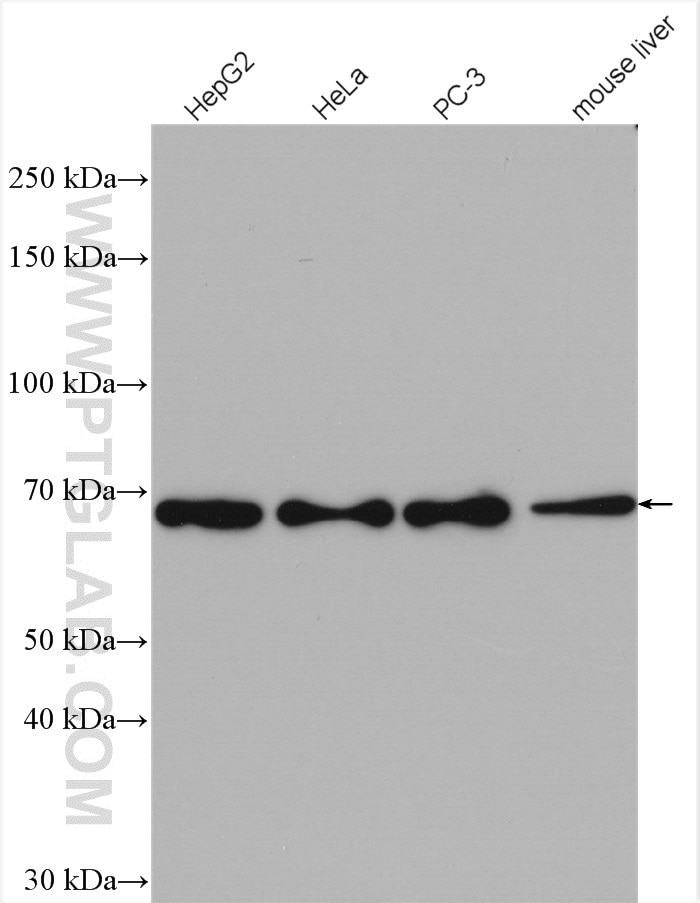 Western Blot (WB) analysis of various lysates using FARSB Polyclonal antibody (16341-1-AP)