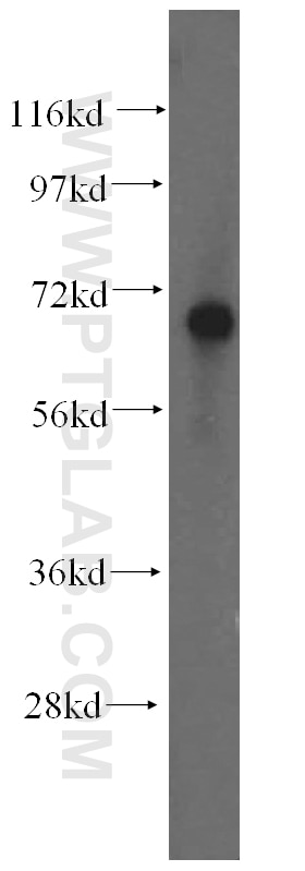 Western Blot (WB) analysis of HL-60 cells using FARSB Polyclonal antibody (16341-1-AP)