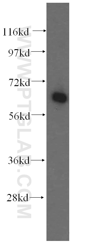 Western Blot (WB) analysis of K-562 cells using FARSB Polyclonal antibody (16341-1-AP)