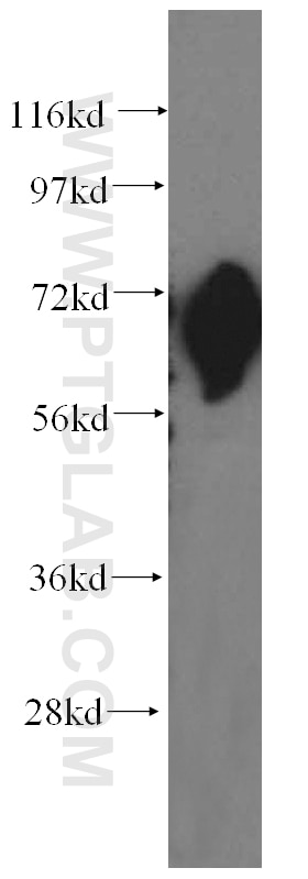 Western Blot (WB) analysis of human liver tissue using FARSB Polyclonal antibody (16341-1-AP)