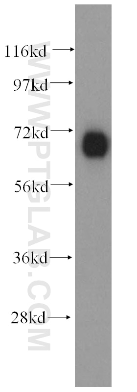 Western Blot (WB) analysis of mouse brain tissue using FARSB Polyclonal antibody (16341-1-AP)