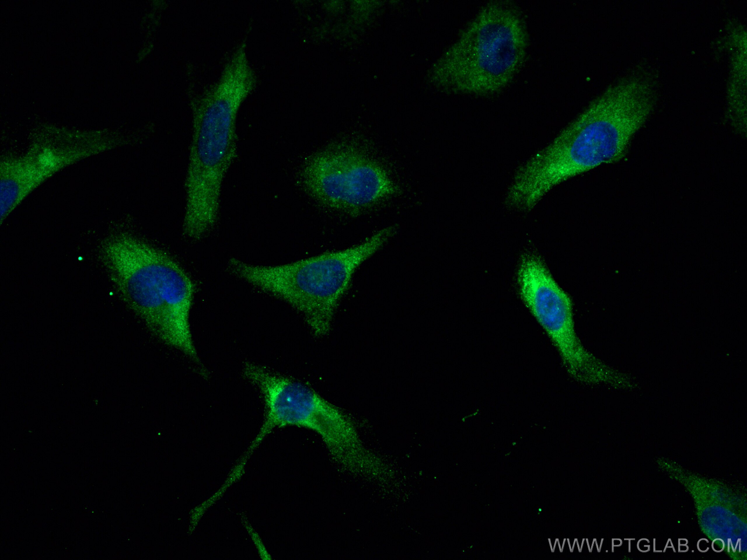Immunofluorescence (IF) / fluorescent staining of HeLa cells using FARSB Monoclonal antibody (67924-1-Ig)