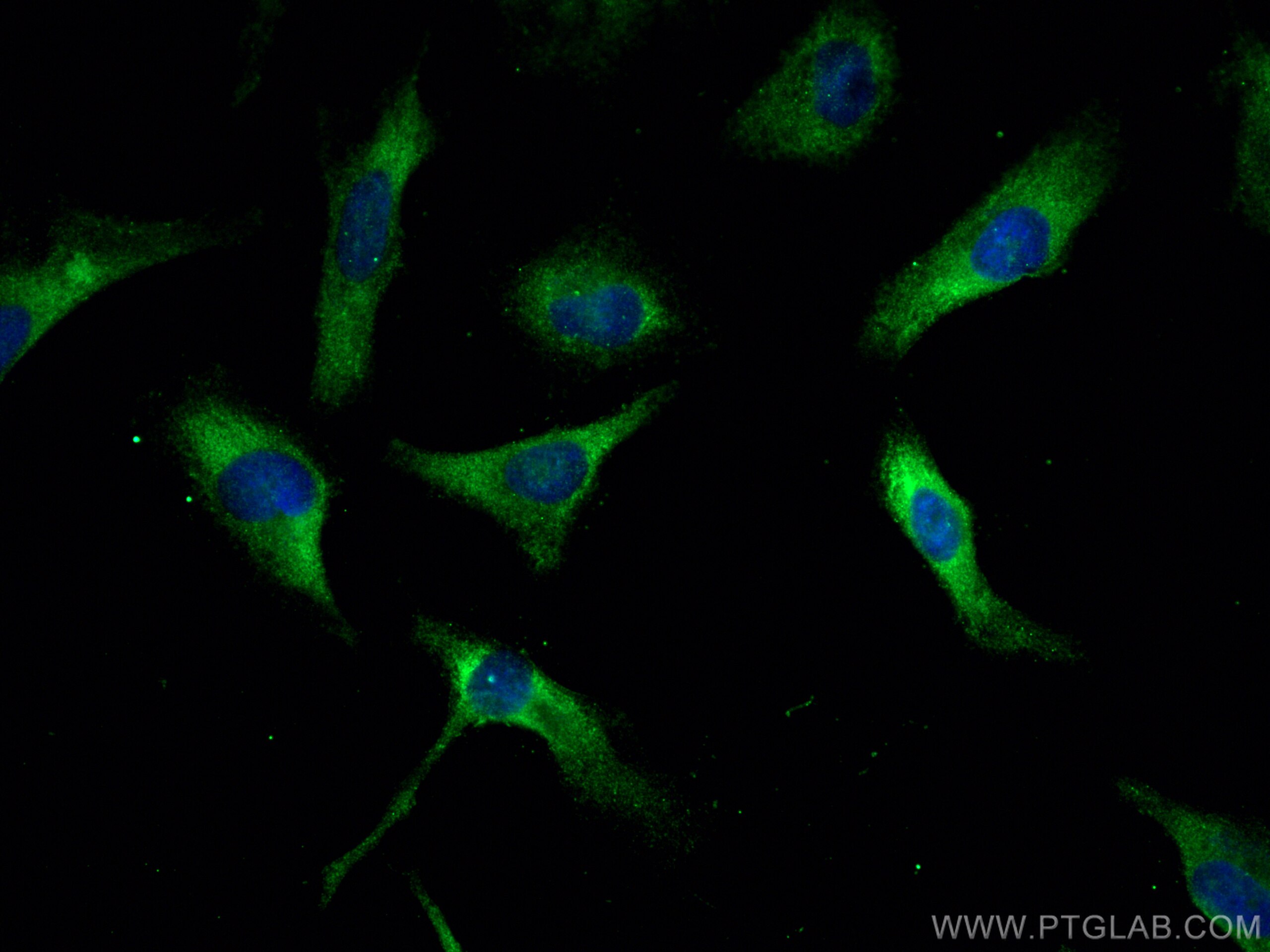 IF Staining of HeLa using 67924-1-Ig