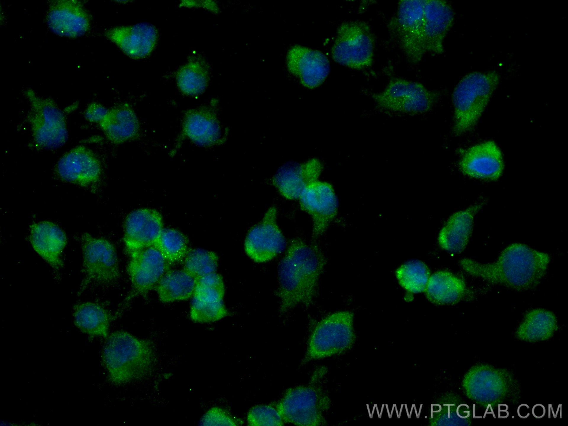 Immunofluorescence (IF) / fluorescent staining of U-251 cells using FARSB Monoclonal antibody (67924-1-Ig)