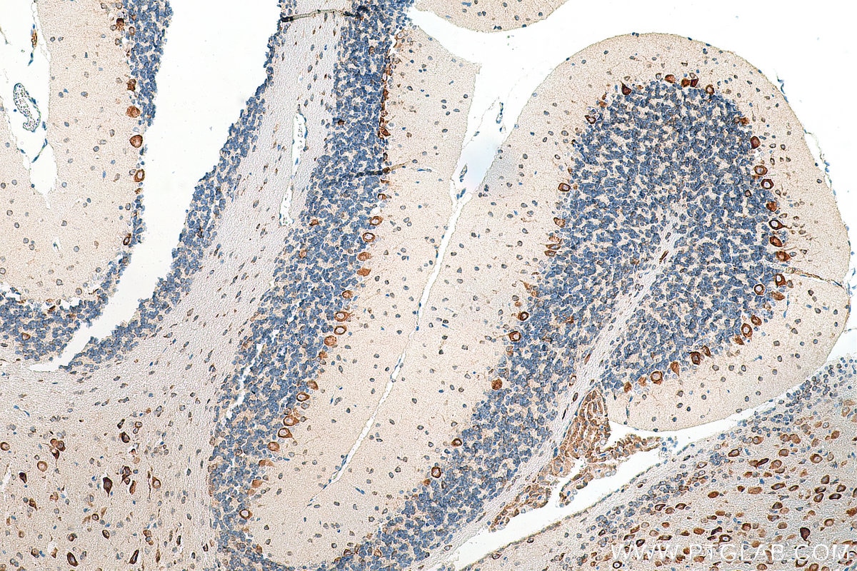 Immunohistochemistry (IHC) staining of mouse cerebellum tissue using FARSB Monoclonal antibody (67924-1-Ig)