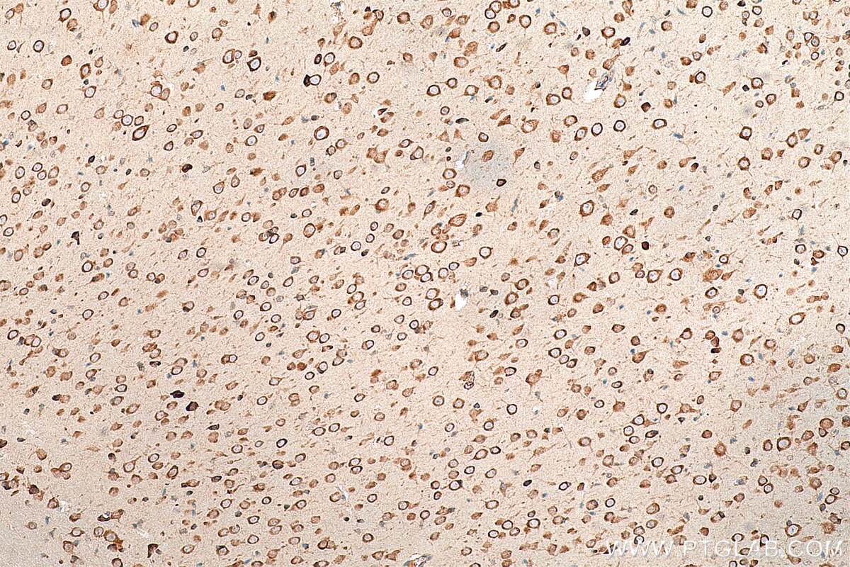 Immunohistochemistry (IHC) staining of mouse brain tissue using FARSB Monoclonal antibody (67924-1-Ig)