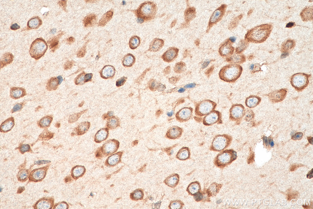 Immunohistochemistry (IHC) staining of mouse brain tissue using FARSB Monoclonal antibody (67924-1-Ig)