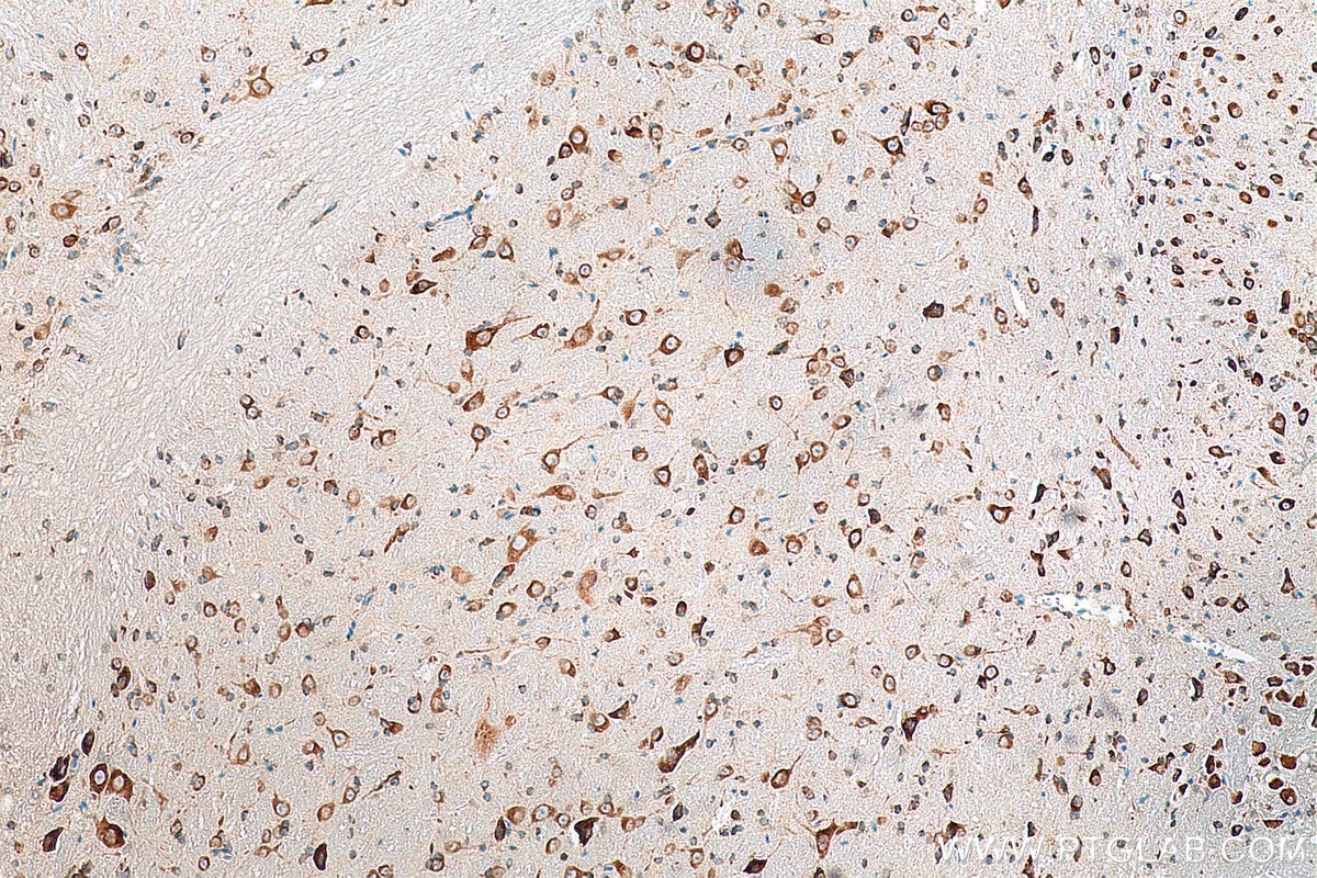 Immunohistochemistry (IHC) staining of mouse cerebellum tissue using FARSB Monoclonal antibody (67924-1-Ig)