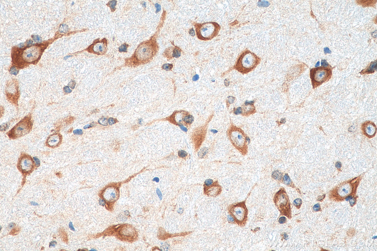 Immunohistochemistry (IHC) staining of mouse cerebellum tissue using FARSB Monoclonal antibody (67924-1-Ig)