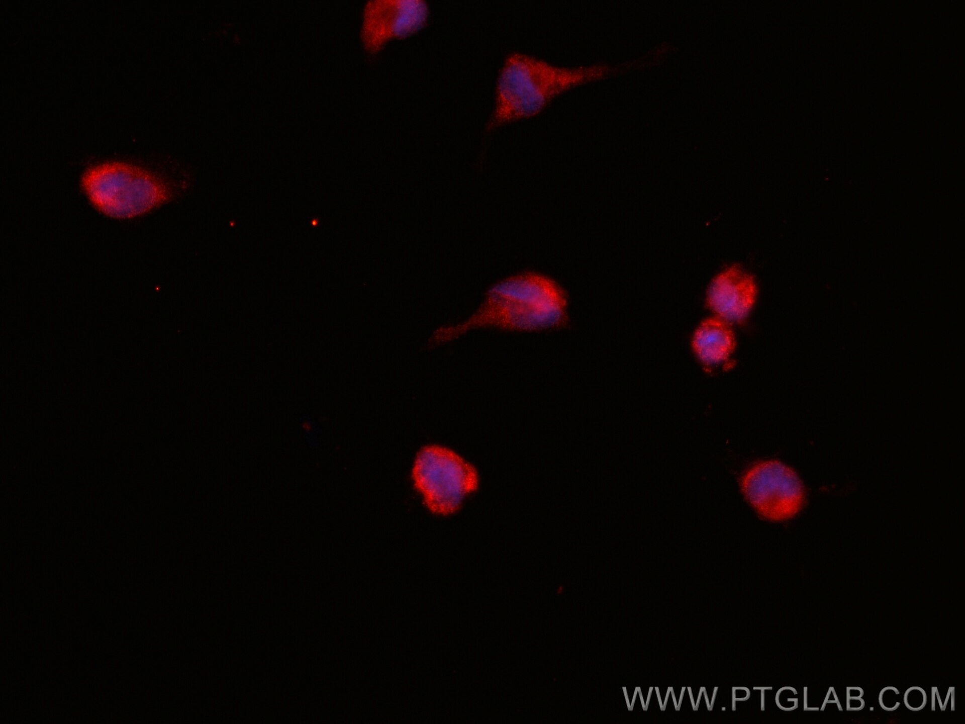 Immunofluorescence (IF) / fluorescent staining of U-251 cells using CoraLite®594-conjugated FARSB Monoclonal antibody (CL594-67924)