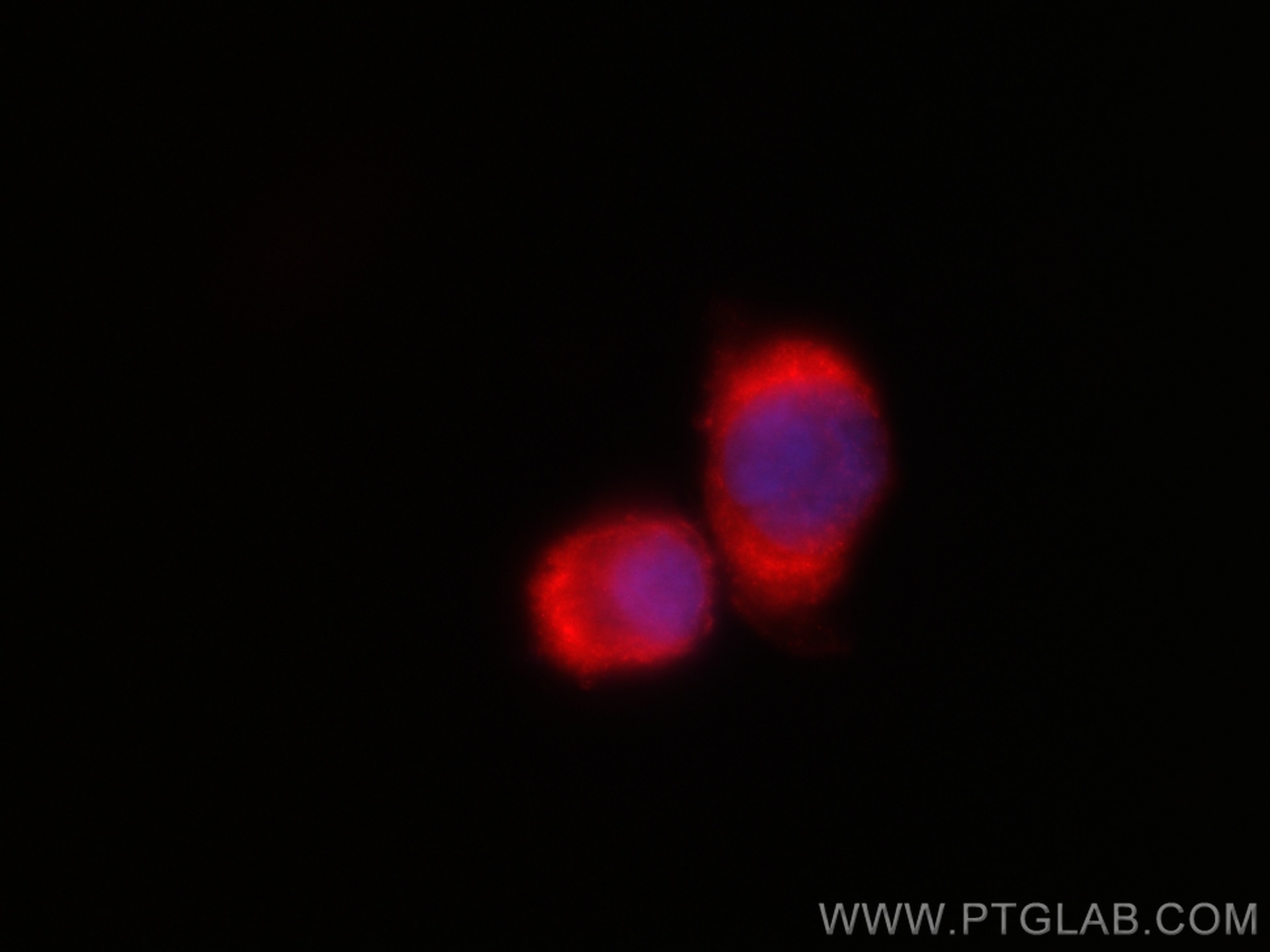 Immunofluorescence (IF) / fluorescent staining of U-251 cells using CoraLite®594-conjugated FARSB Monoclonal antibody (CL594-67924)