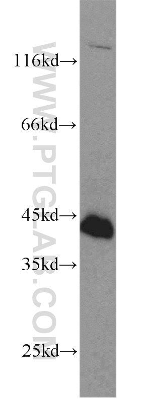 FAS/CD95 Polyclonal antibody