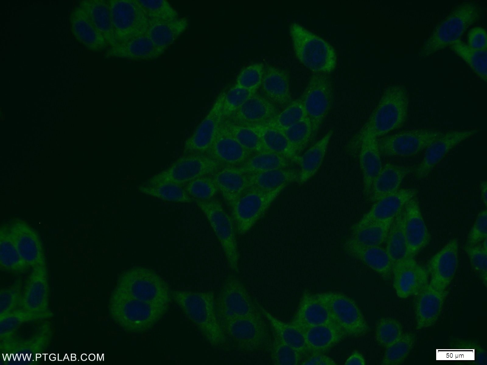 Immunofluorescence (IF) / fluorescent staining of HepG2 cells using FASN Polyclonal antibody (10624-2-AP)
