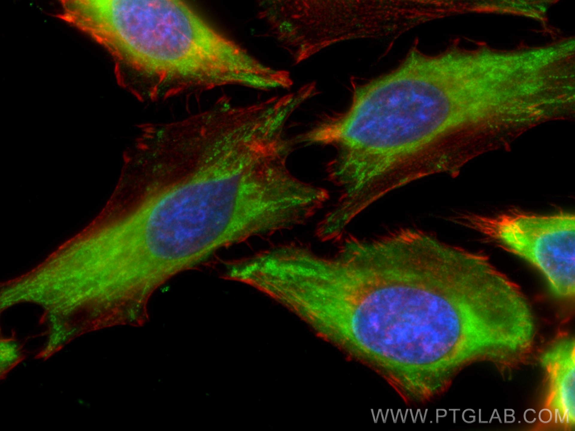 Immunofluorescence (IF) / fluorescent staining of HeLa cells using FASN Polyclonal antibody (10624-2-AP)