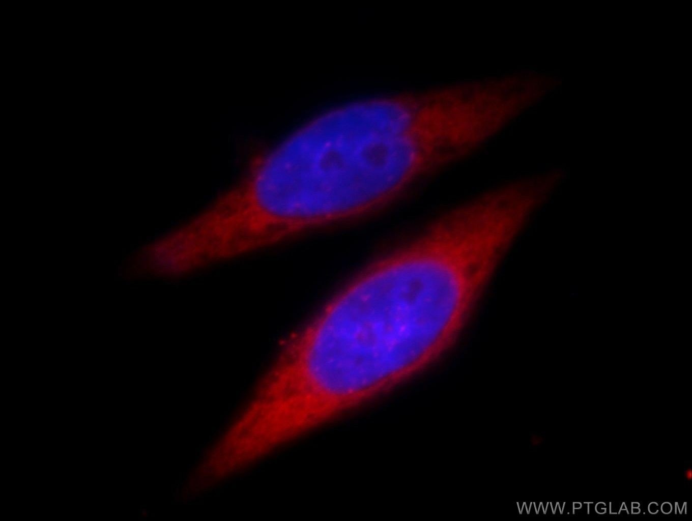 FASN Polyclonal antibody