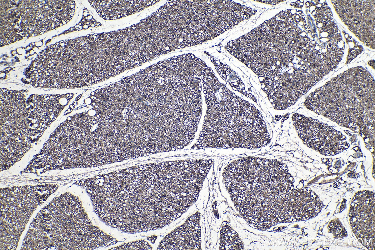 Immunohistochemistry (IHC) staining of mouse brown adipose tissue using FASN Polyclonal antibody (10624-2-AP)