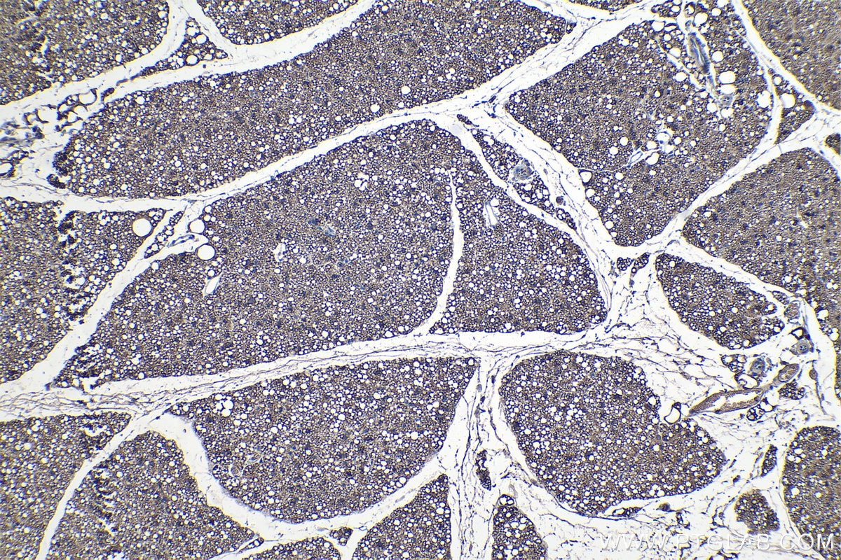 IHC staining of mouse brown adipose using 10624-2-AP