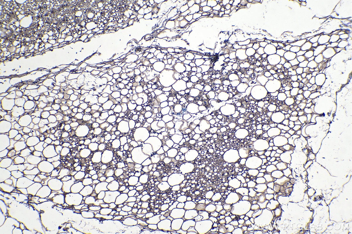Immunohistochemistry (IHC) staining of rat brown adipose tissue using FASN Polyclonal antibody (10624-2-AP)