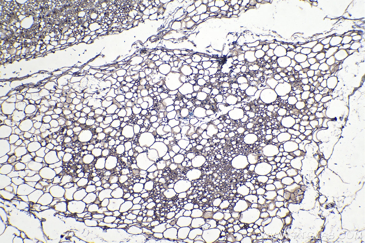 IHC staining of rat brown adipose using 10624-2-AP