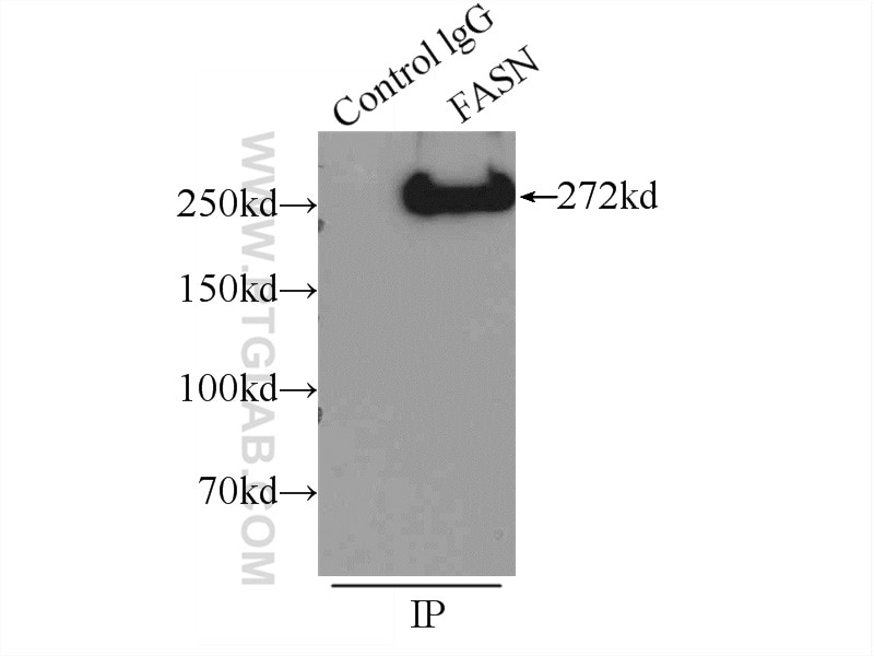 Immunoprecipitation (IP) experiment of mouse liver tissue using FASN Polyclonal antibody (10624-2-AP)