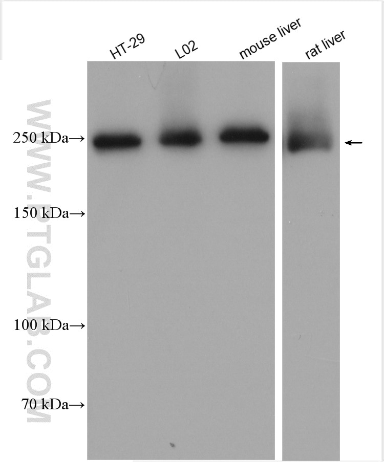 Western Blot (WB) analysis of various lysates using FASN Polyclonal antibody (10624-2-AP)