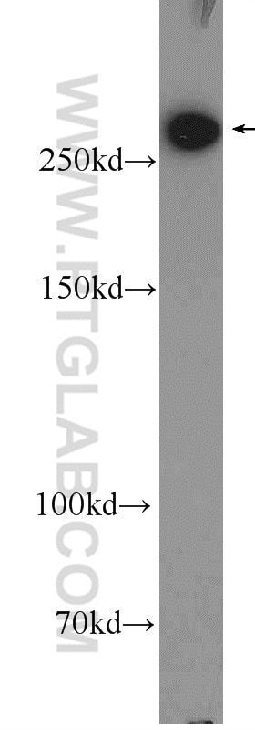 FASN Polyclonal antibody