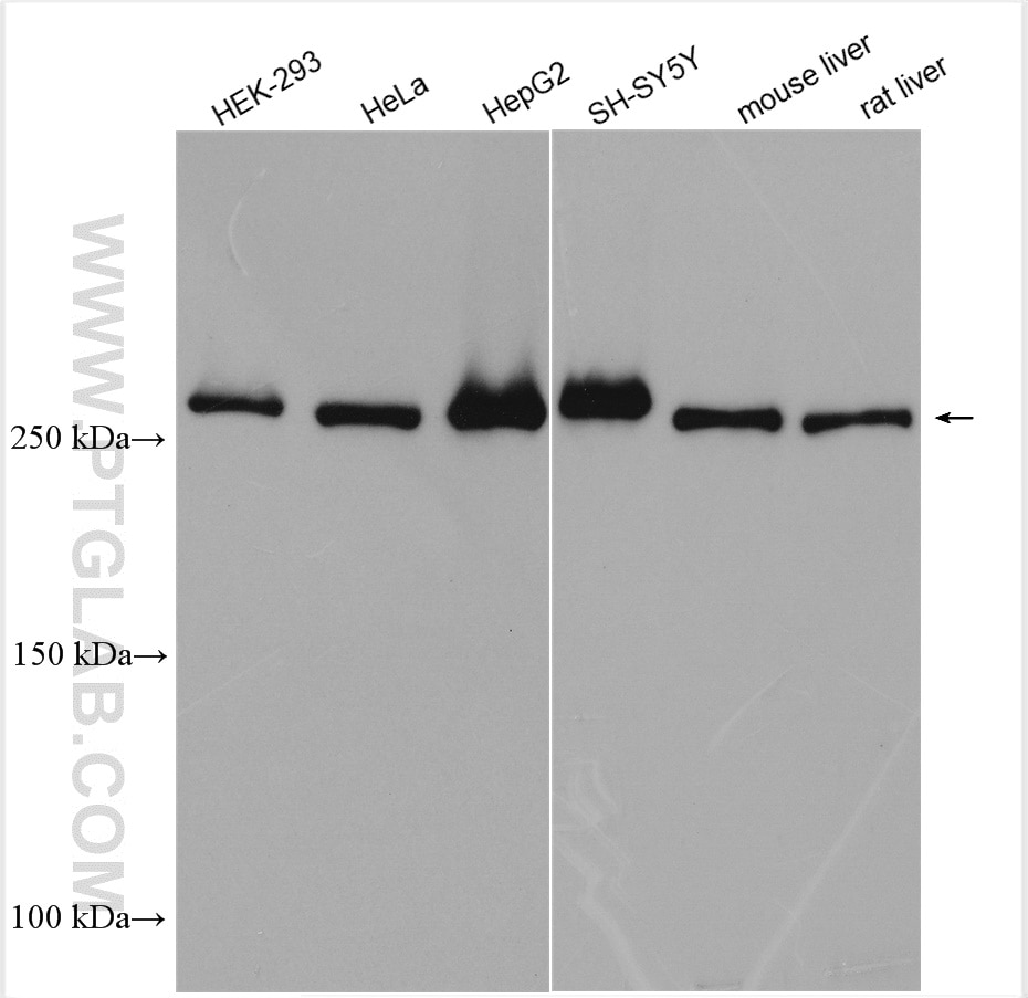 Western Blot (WB) analysis of various lysates using FASN Polyclonal antibody (10624-2-AP)