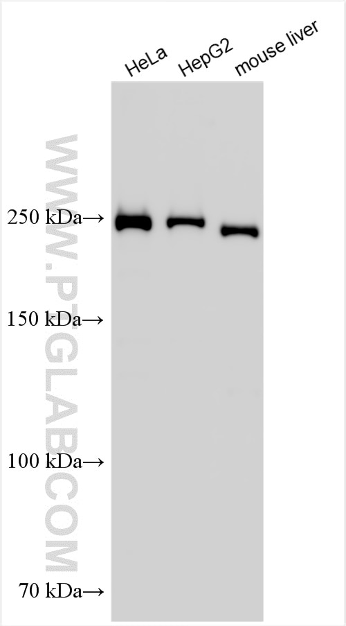 Western Blot (WB) analysis of various lysates using FASN Polyclonal antibody (10624-2-AP)