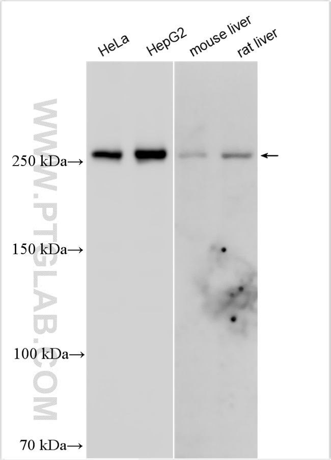 Western Blot (WB) analysis of various lysates using FASN Polyclonal antibody (10624-2-AP)