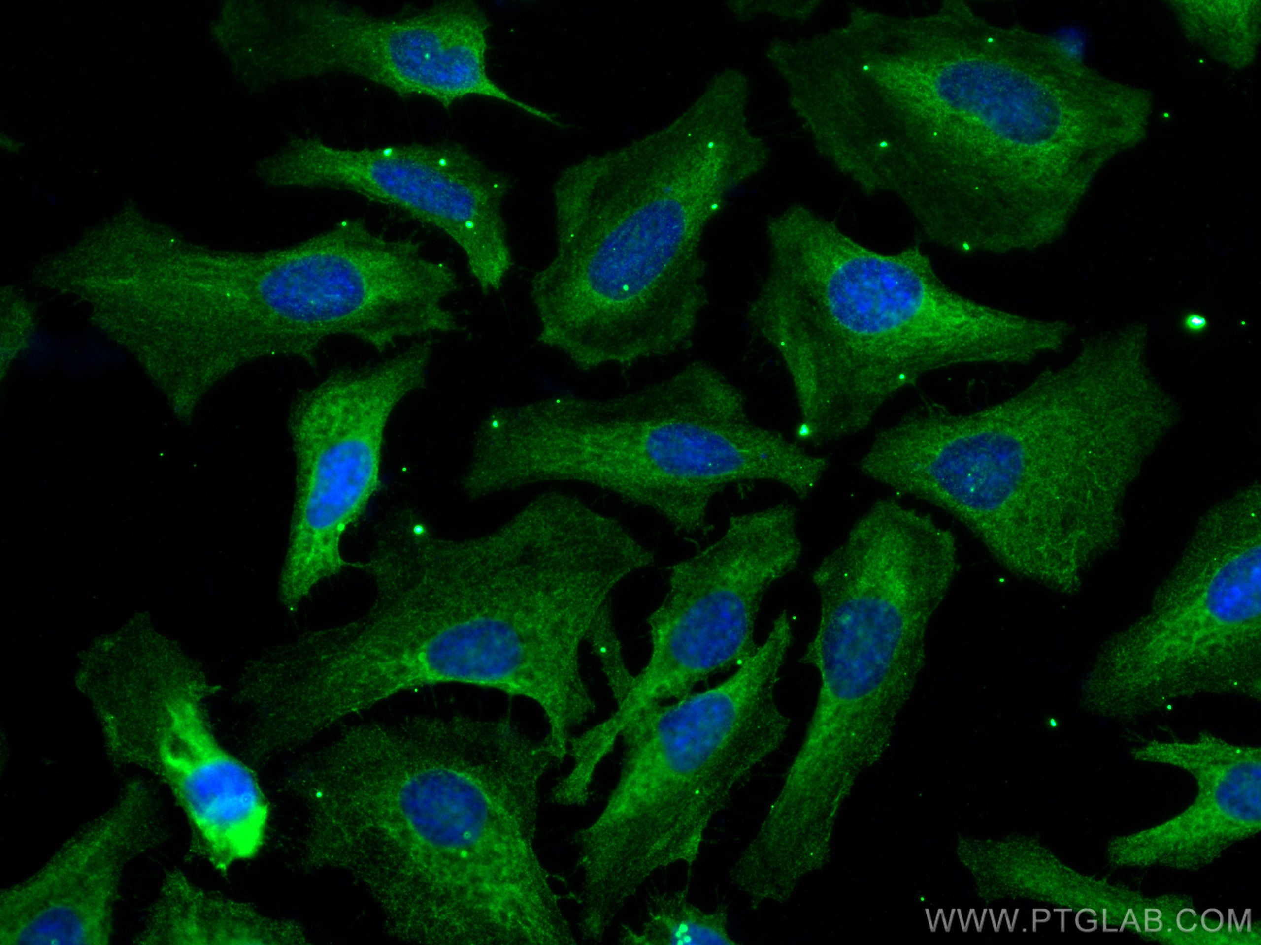 Immunofluorescence (IF) / fluorescent staining of HeLa cells using FASN Monoclonal antibody (66591-1-Ig)