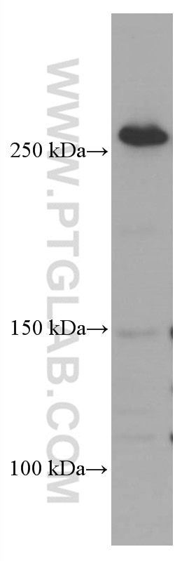 Western Blot (WB) analysis of HEK-293 cells using FASN Monoclonal antibody (66591-1-Ig)