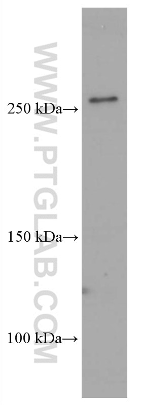 Western Blot (WB) analysis of Jurkat cells using FASN Monoclonal antibody (66591-1-Ig)