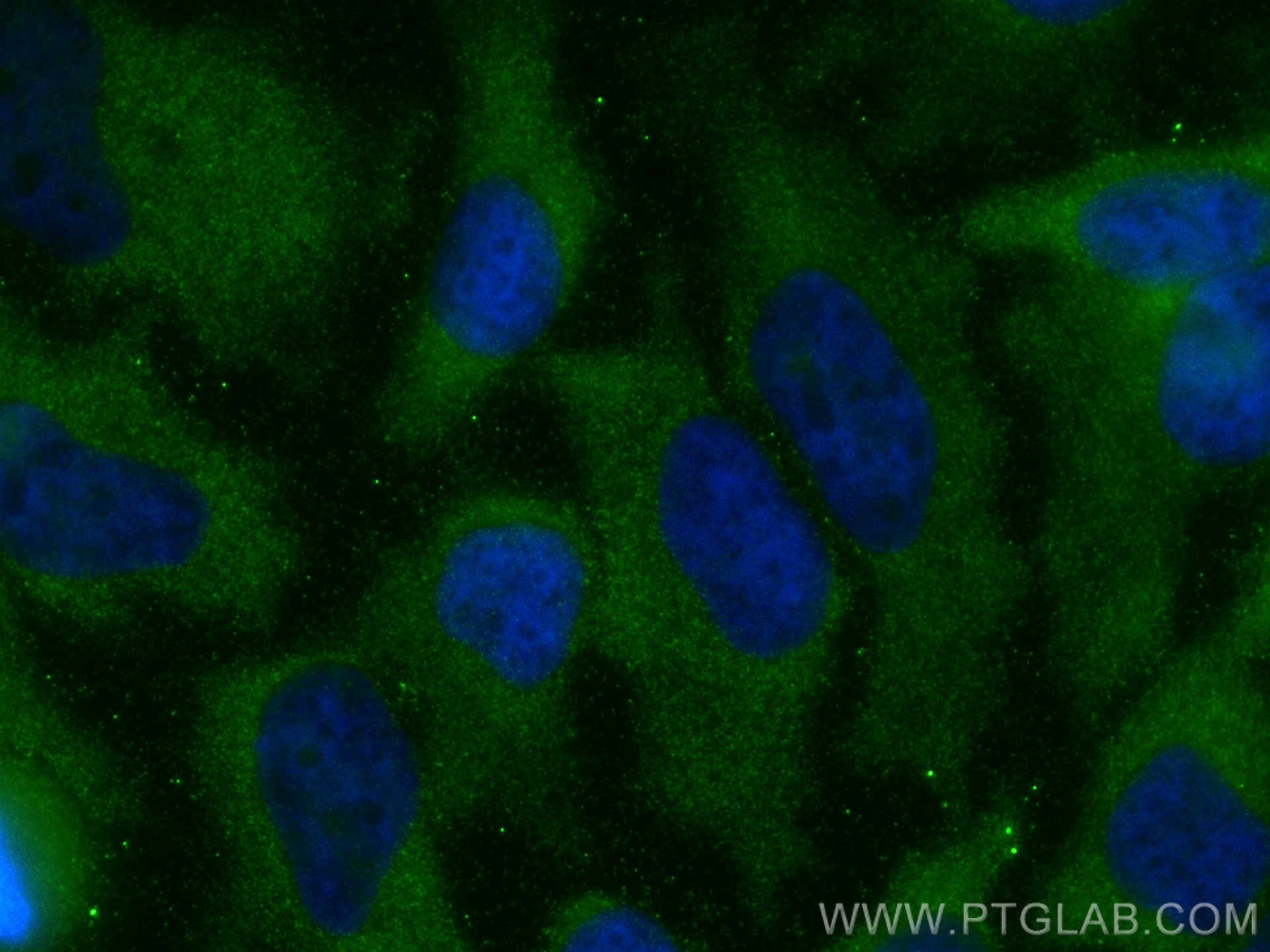 Immunofluorescence (IF) / fluorescent staining of HeLa cells using FASN Recombinant antibody (81079-1-RR)