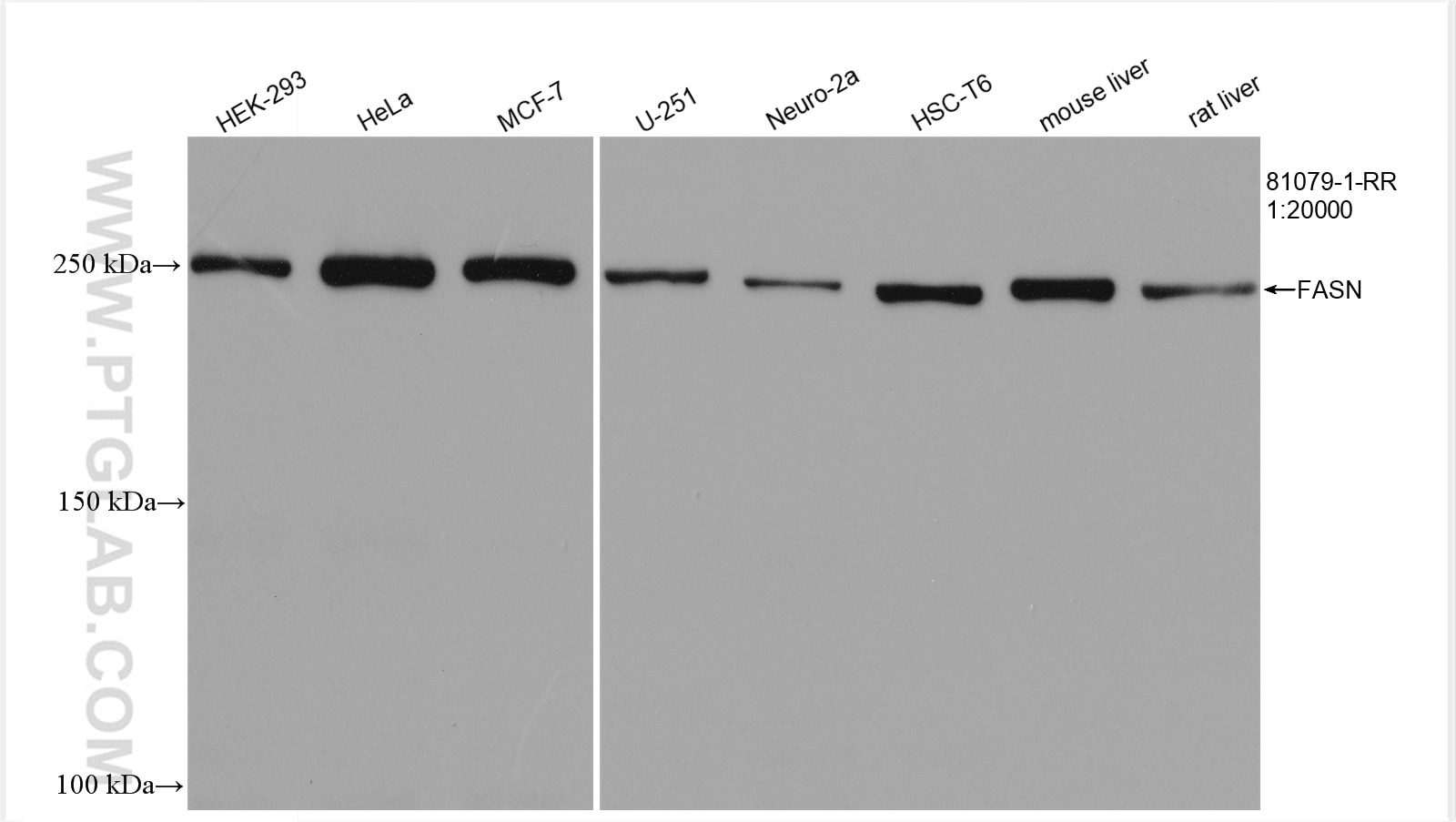 Western Blot (WB) analysis of various lysates using FASN Recombinant antibody (81079-1-RR)