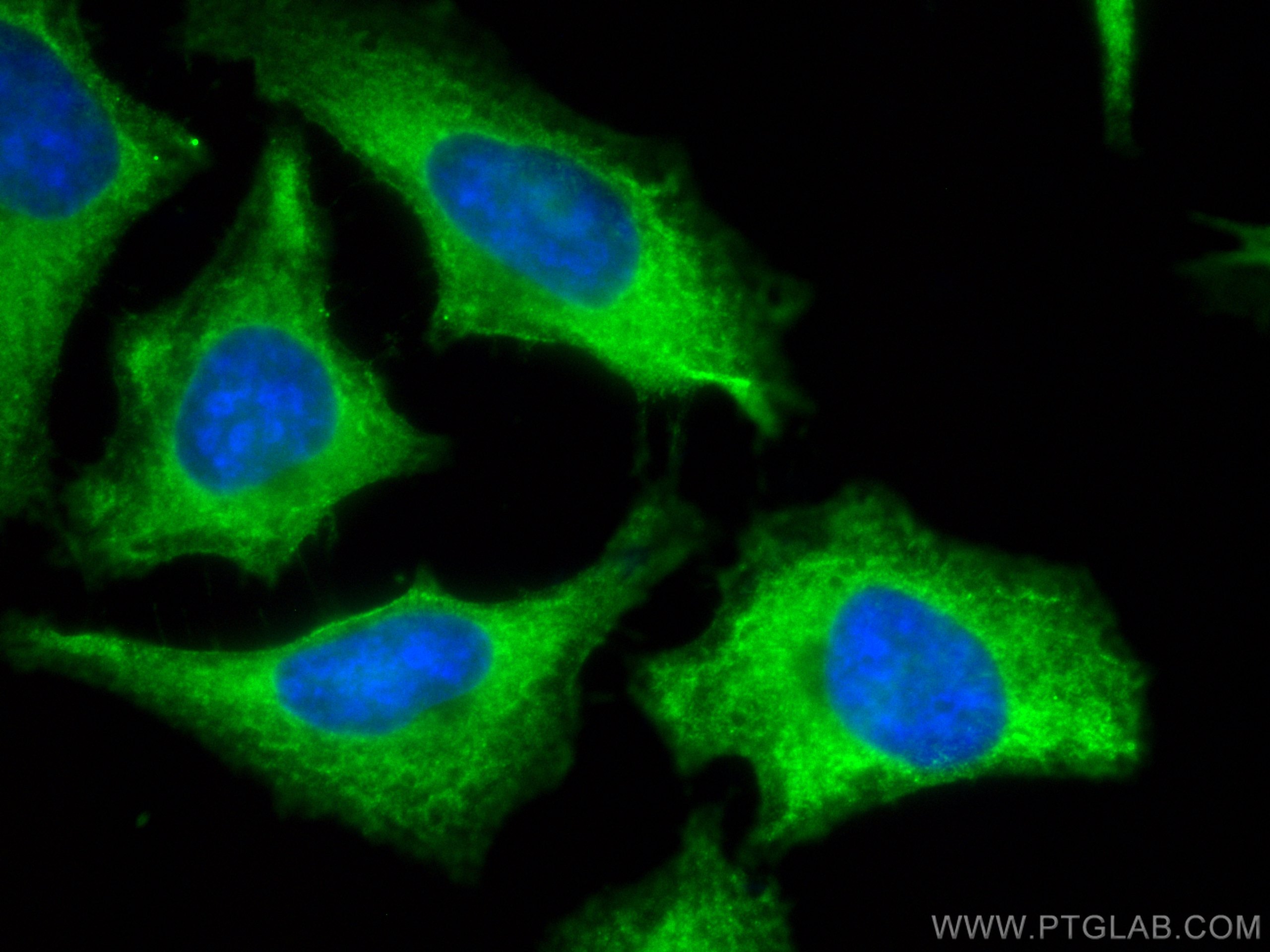 Immunofluorescence (IF) / fluorescent staining of HeLa cells using CoraLite® Plus 488-conjugated FASN Monoclonal anti (CL488-66591)