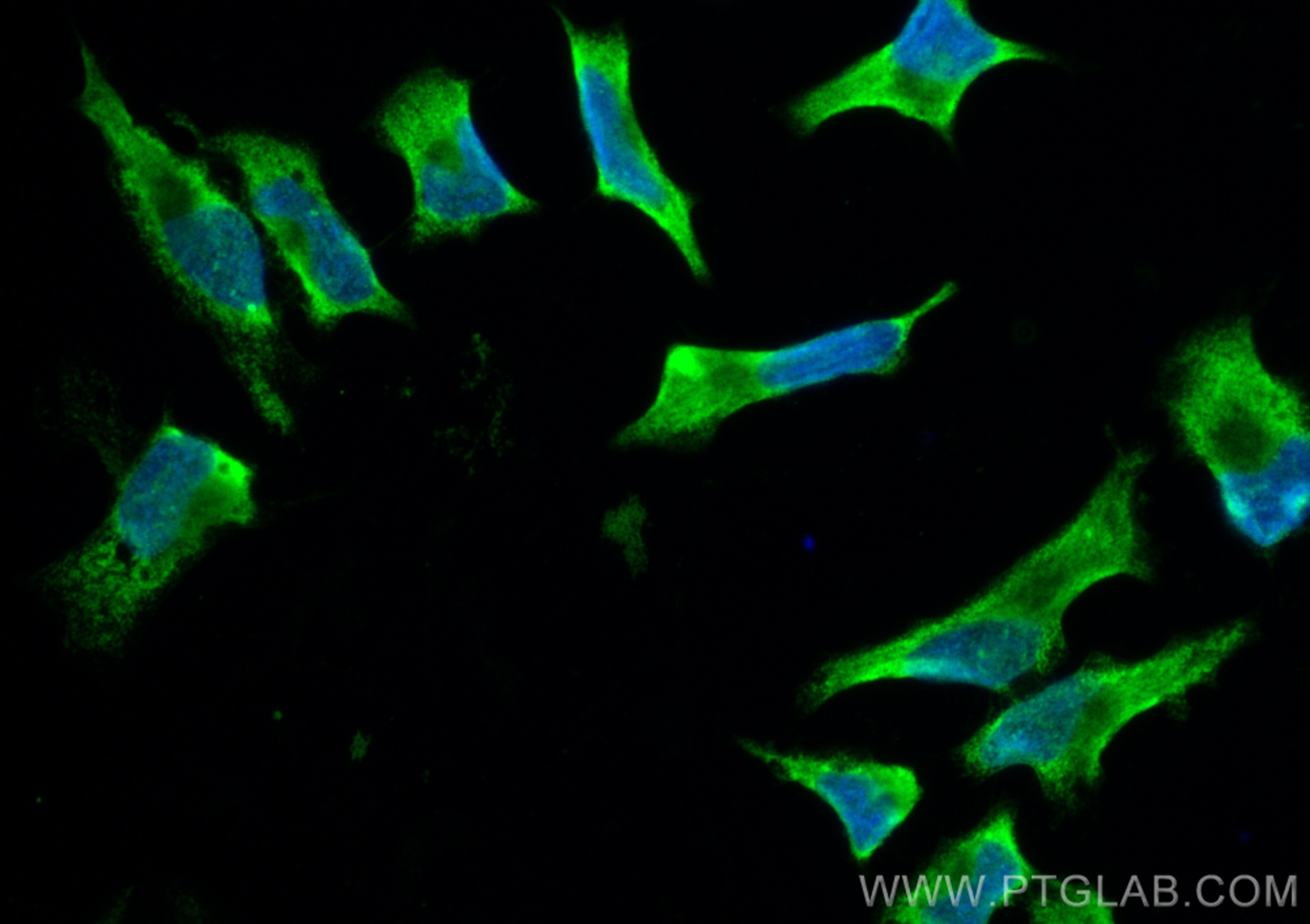 Immunofluorescence (IF) / fluorescent staining of HeLa cells using CoraLite® Plus 488-conjugated FASN Recombinant ant (CL488-81079)