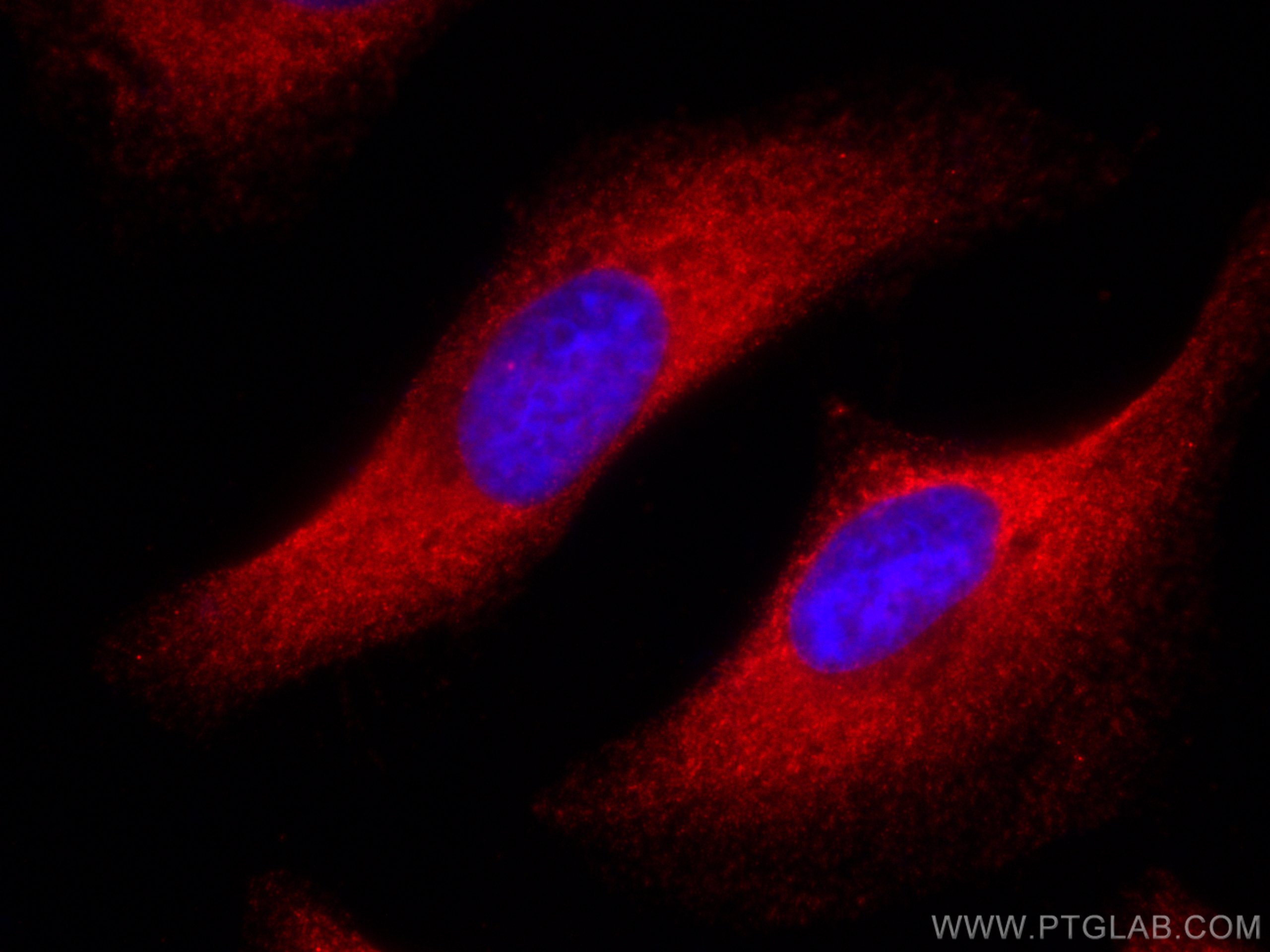 Immunofluorescence (IF) / fluorescent staining of HeLa cells using CoraLite®594-conjugated FASN Monoclonal antibody (CL594-66591)