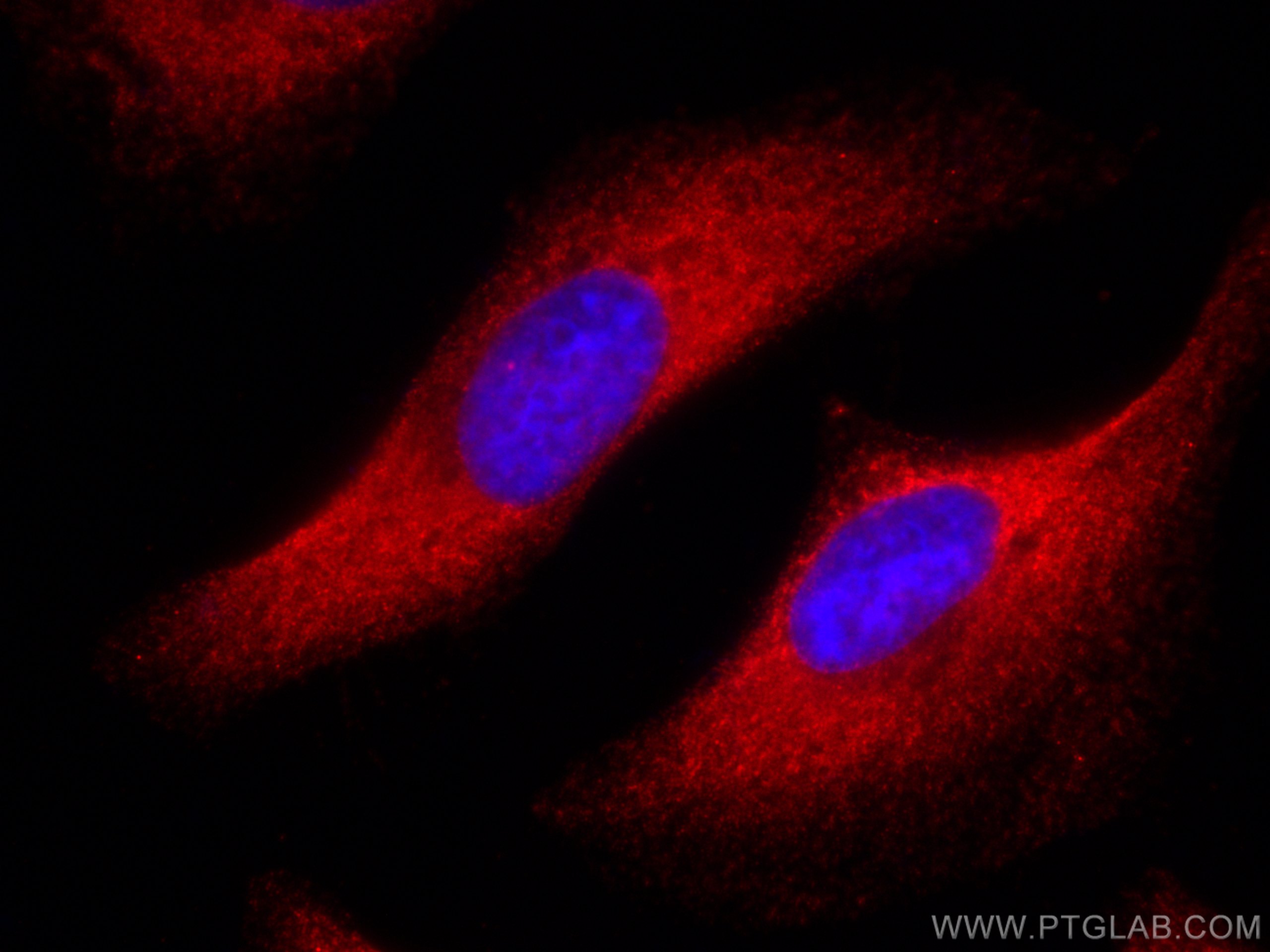 IF Staining of HeLa using CL594-66591