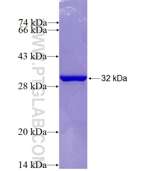 FASN fusion protein Ag27077 SDS-PAGE