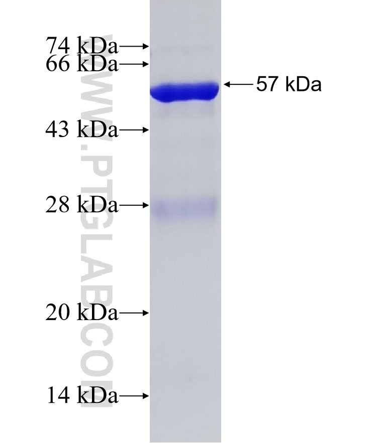 FASN fusion protein Ag0975 SDS-PAGE