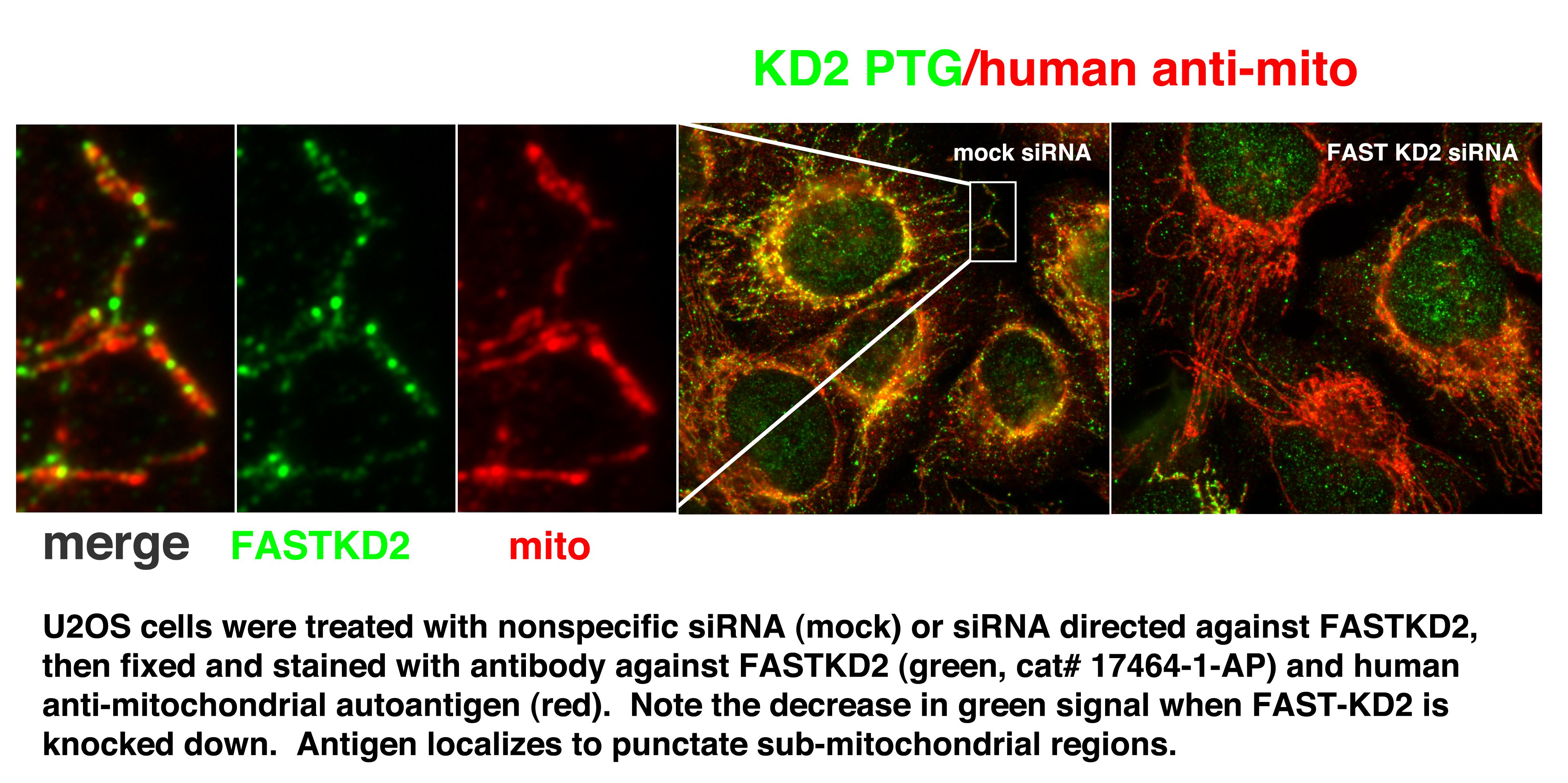 Immunofluorescence (IF) / fluorescent staining of U2OS cells using FASTKD2 Polyclonal antibody (17464-1-AP)