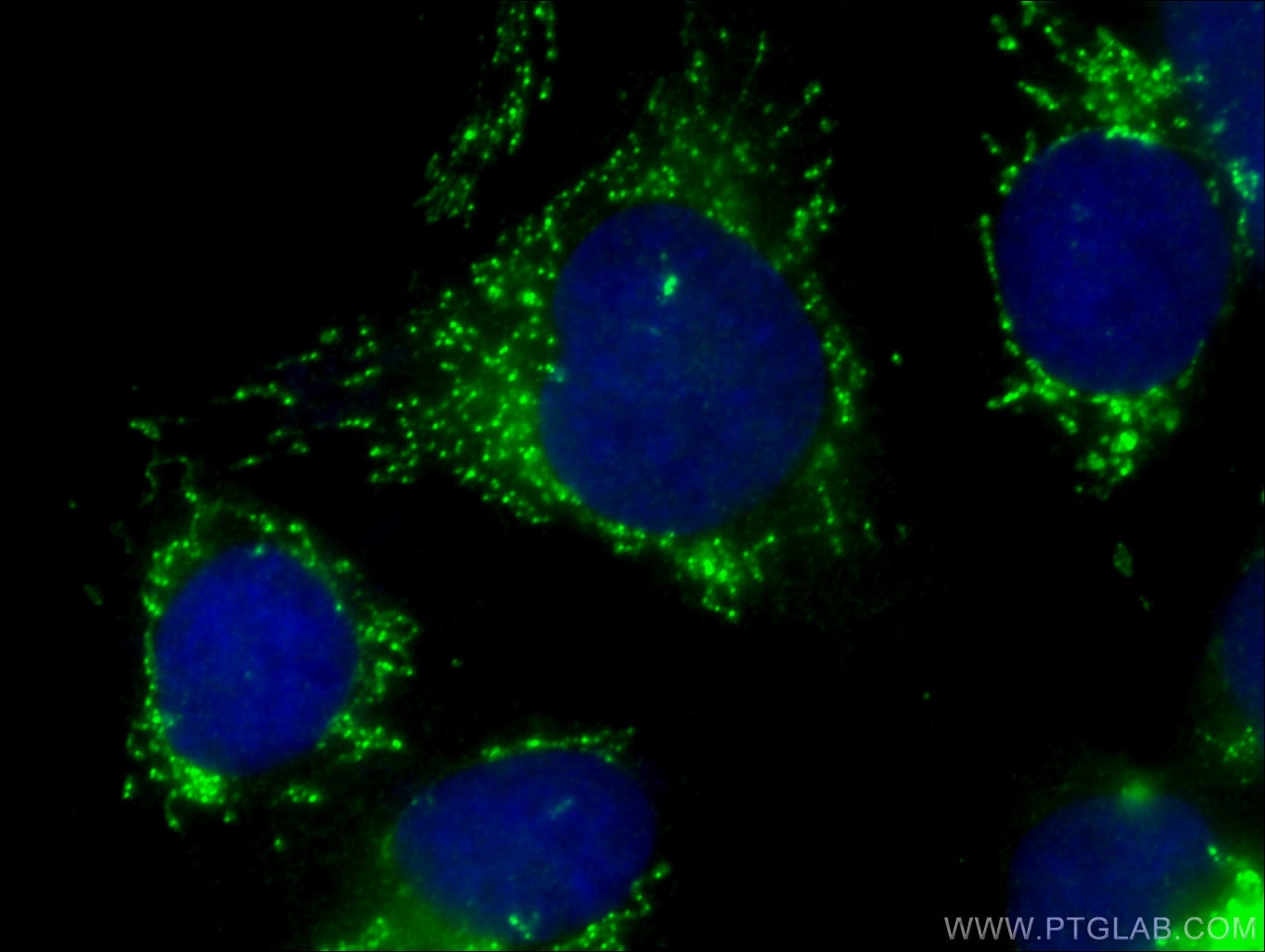 Immunofluorescence (IF) / fluorescent staining of U2OS cells using FASTKD2 Polyclonal antibody (17464-1-AP)