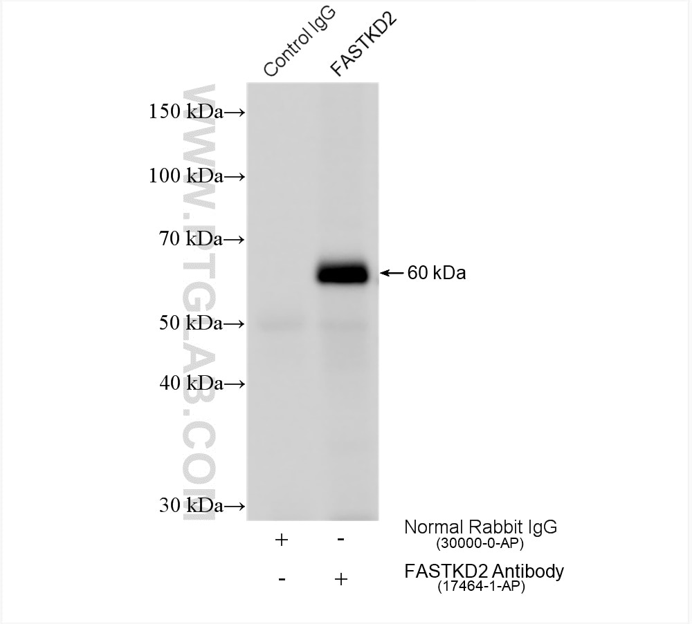 Immunoprecipitation (IP) experiment of HepG2 cells using FASTKD2 Polyclonal antibody (17464-1-AP)