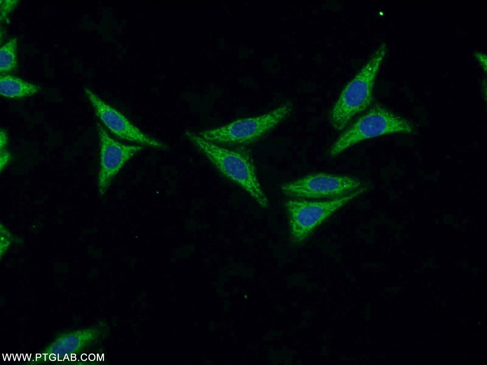 Immunofluorescence (IF) / fluorescent staining of HepG2 cells using FASTKD3 Polyclonal antibody (18392-1-AP)