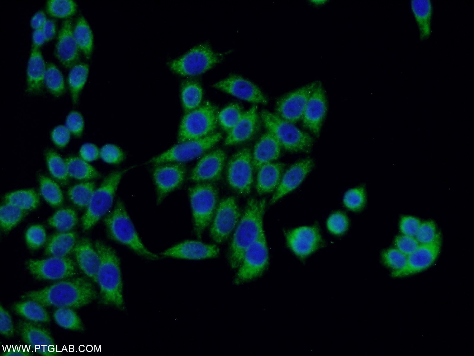 Immunofluorescence (IF) / fluorescent staining of HeLa cells using FASTKD3 Polyclonal antibody (18392-1-AP)