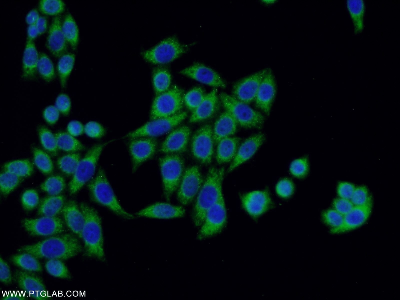 IF Staining of HeLa using 18392-1-AP