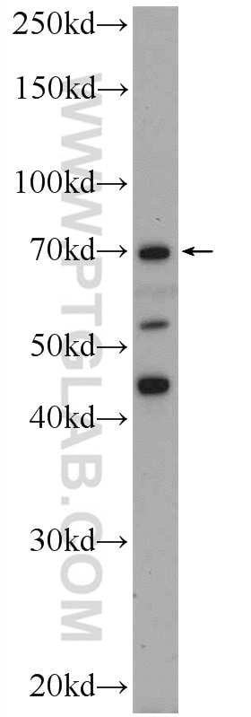 Western Blot (WB) analysis of HepG2 cells using FASTKD3 Polyclonal antibody (18392-1-AP)