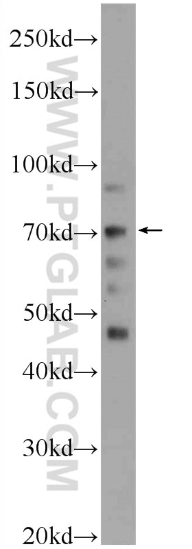 Western Blot (WB) analysis of HeLa cells using FASTKD3 Polyclonal antibody (18392-1-AP)