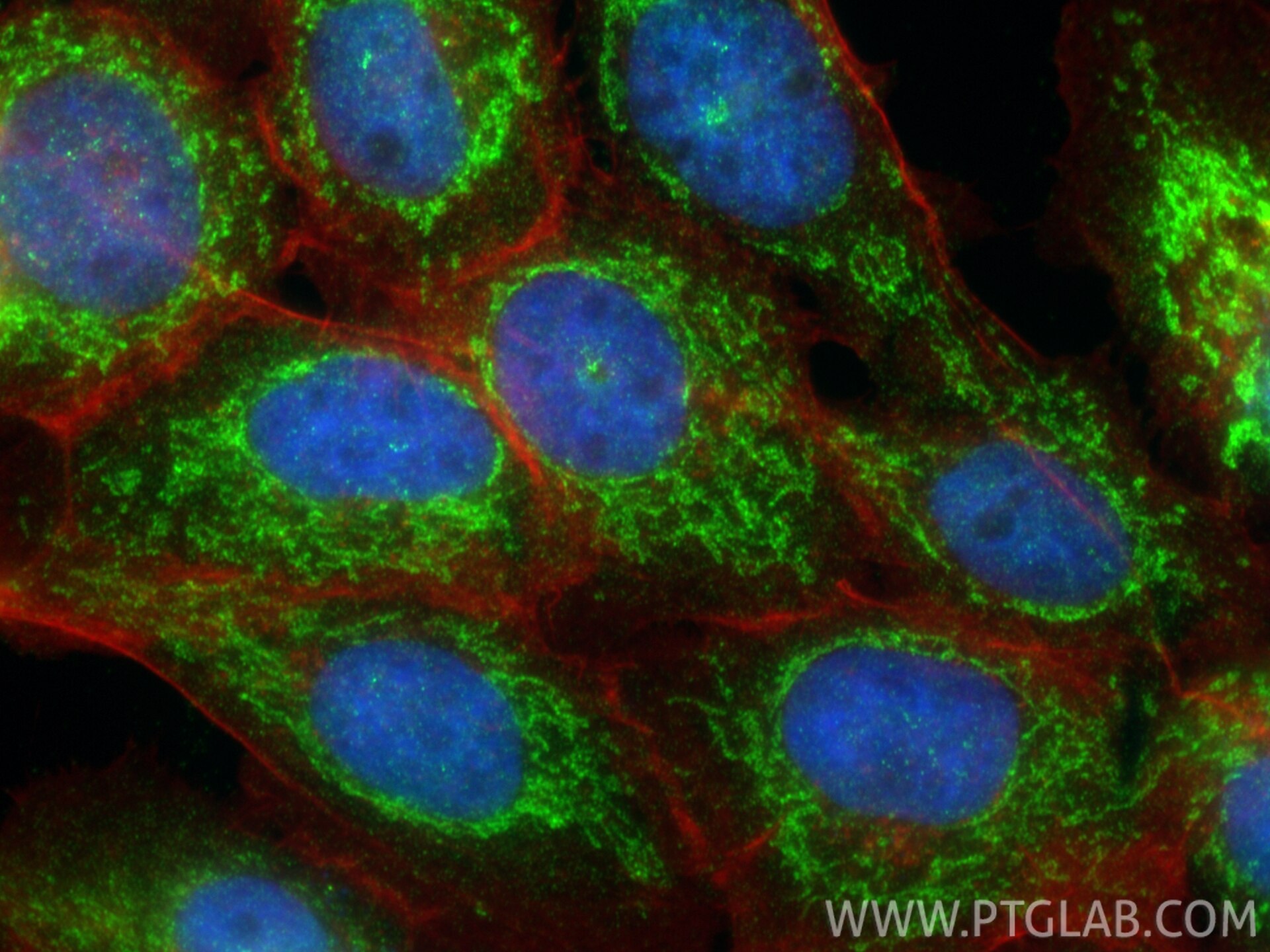 IF Staining of A431 using 20488-1-AP (same clone as 20488-1-PBS) Immunofluorescence (IF) / fluorescent staining of A431 cells using FASTKD5 Polyclonal antibody (20488-1-AP)