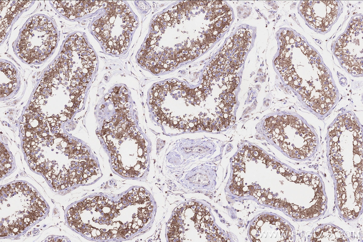 Immunohistochemistry (IHC) staining of human testis tissue using FATE1 Polyclonal antibody (23809-1-AP)